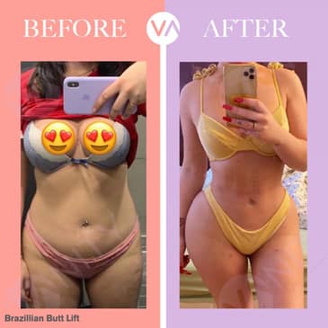 Slider image (3) Vanity Cosmetic Surgery Hospital